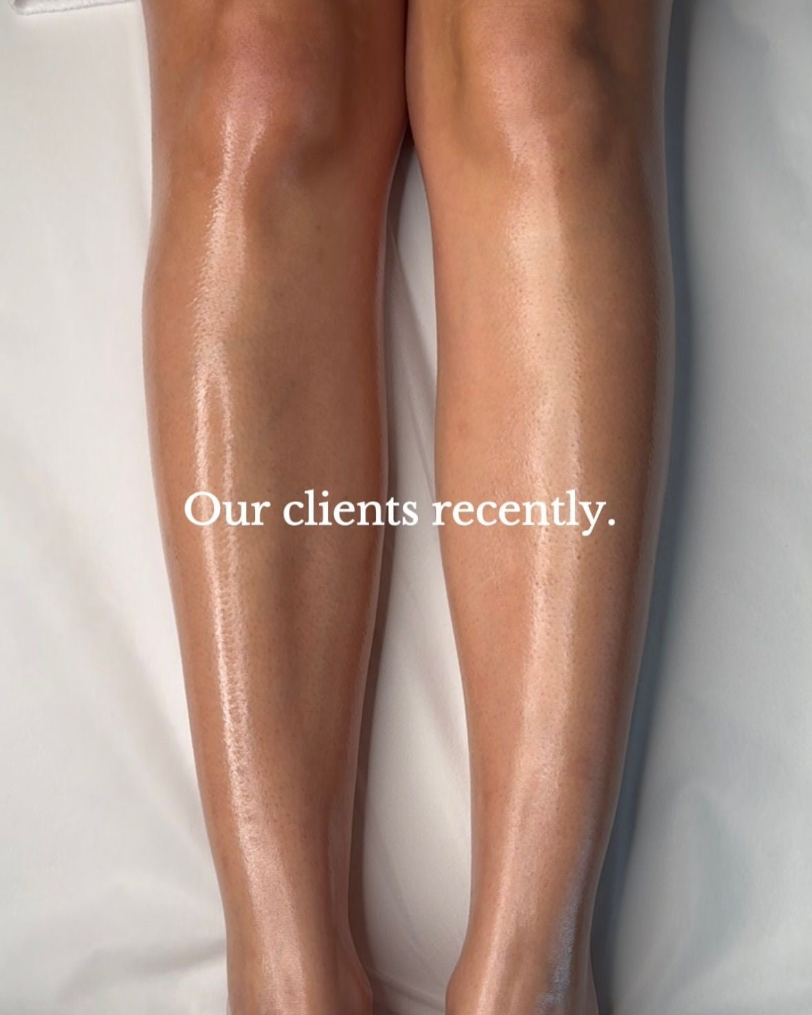 Shiny legs with a text overlay 'Our clients recently.' on a white background