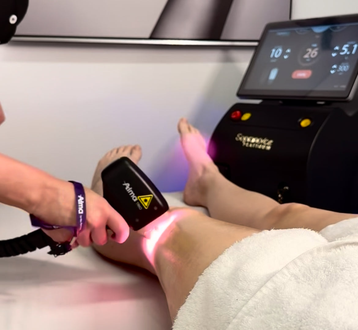 Person receiving a painless laser hair removal on their legs in the treatment room at ID Beauty in Kingston, ON